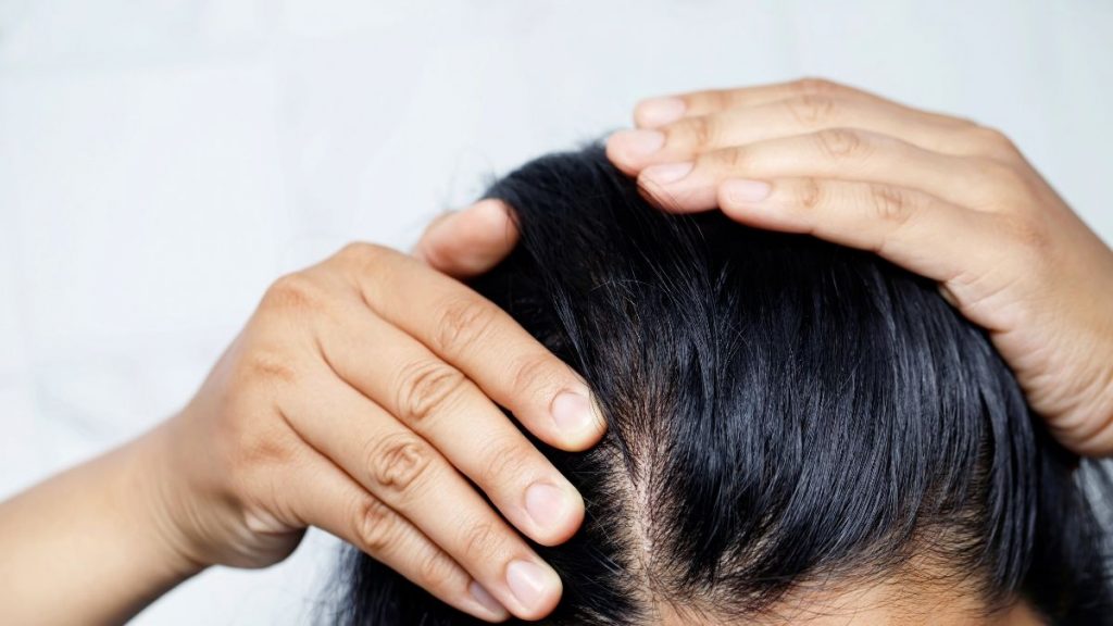 Cabello-Graso